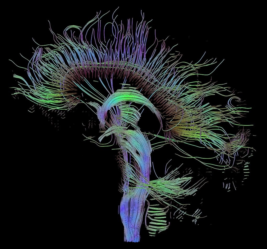 Reserva-cognitiva-y-cerebral-NeuroClass