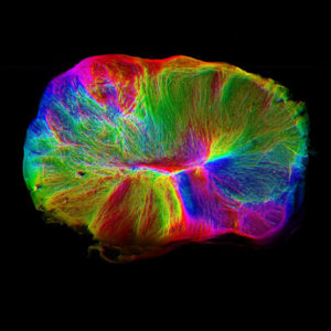 Organoides Cerebrales- NeuroClass