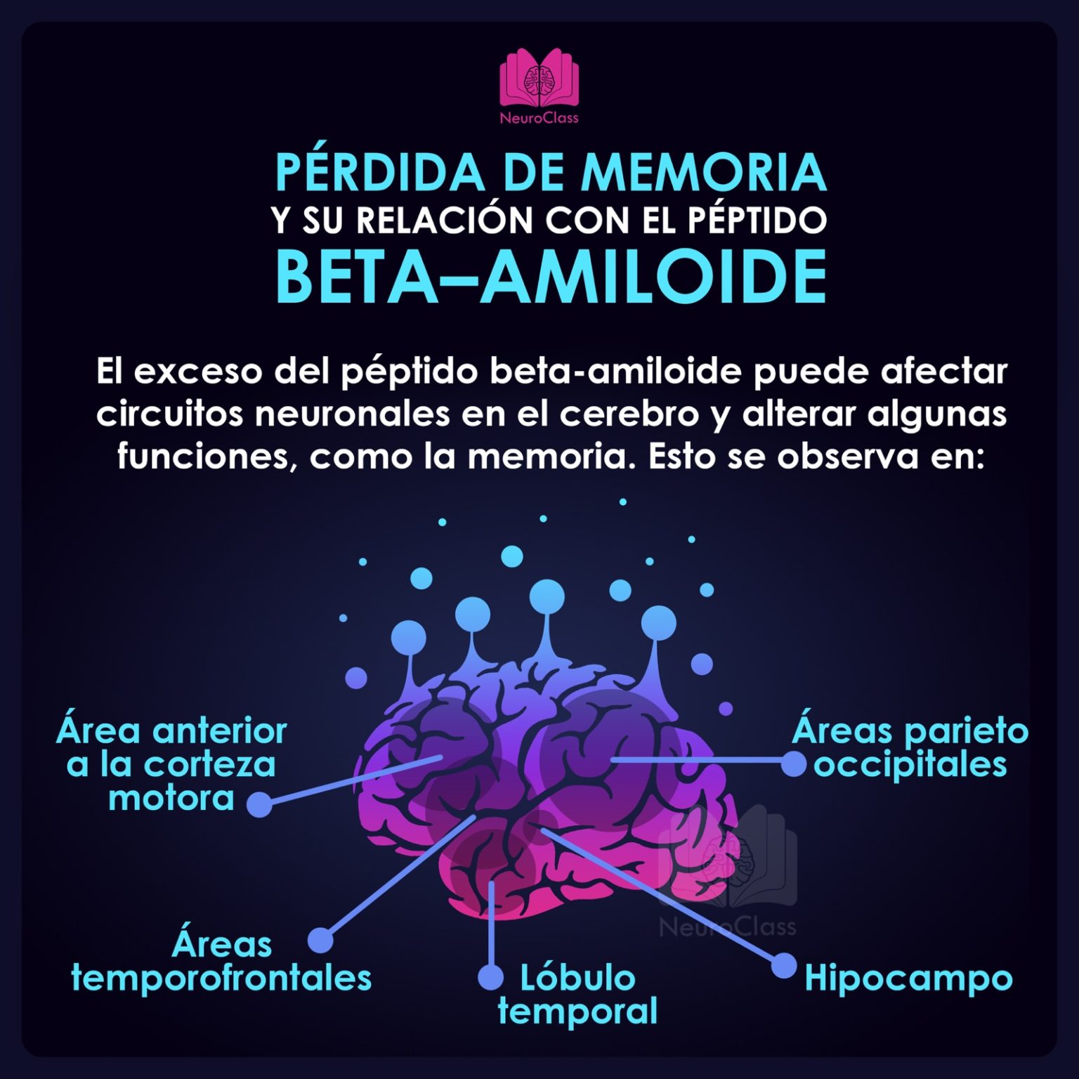 Conociendo El Cerebro A Trav S De Las Im Genes Cerebrales Neuroclass