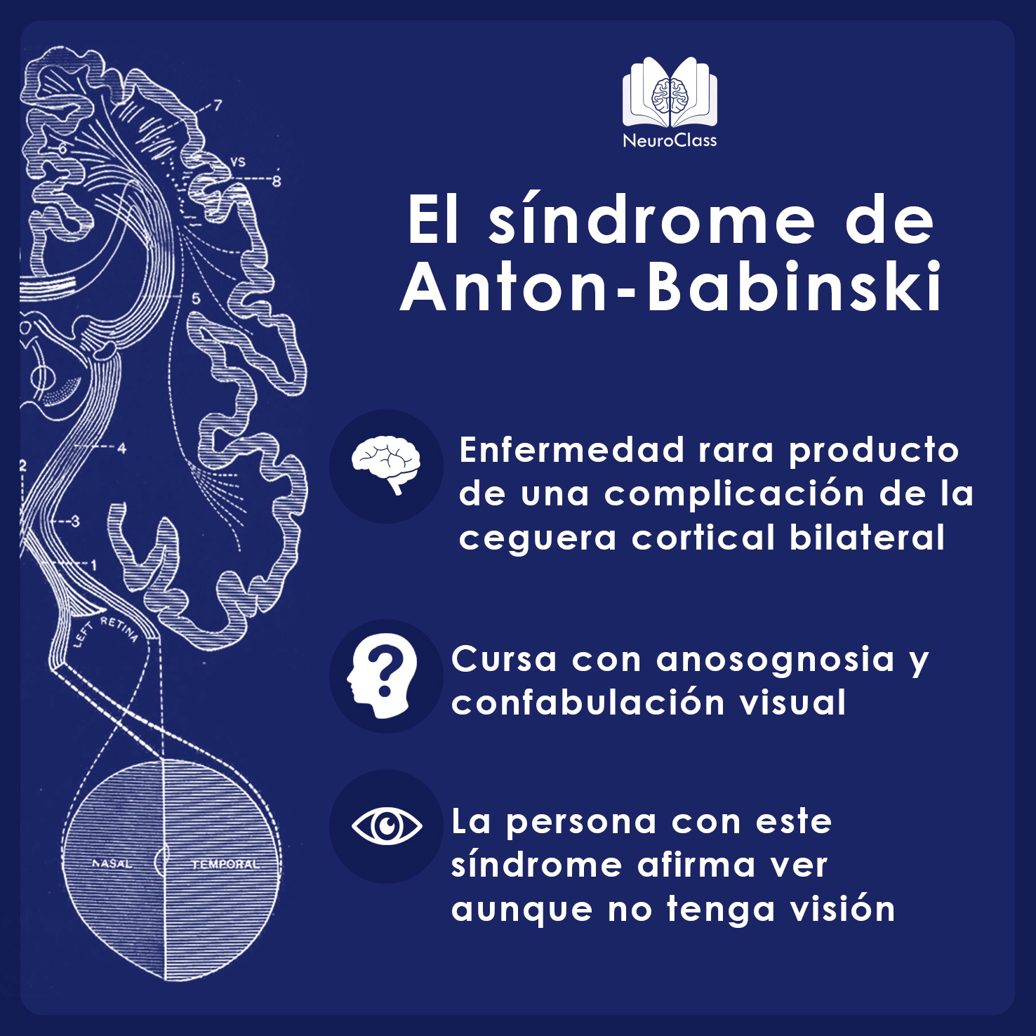 El síndrome de Anton-Babinski: Ver sin visión - NeuroClass