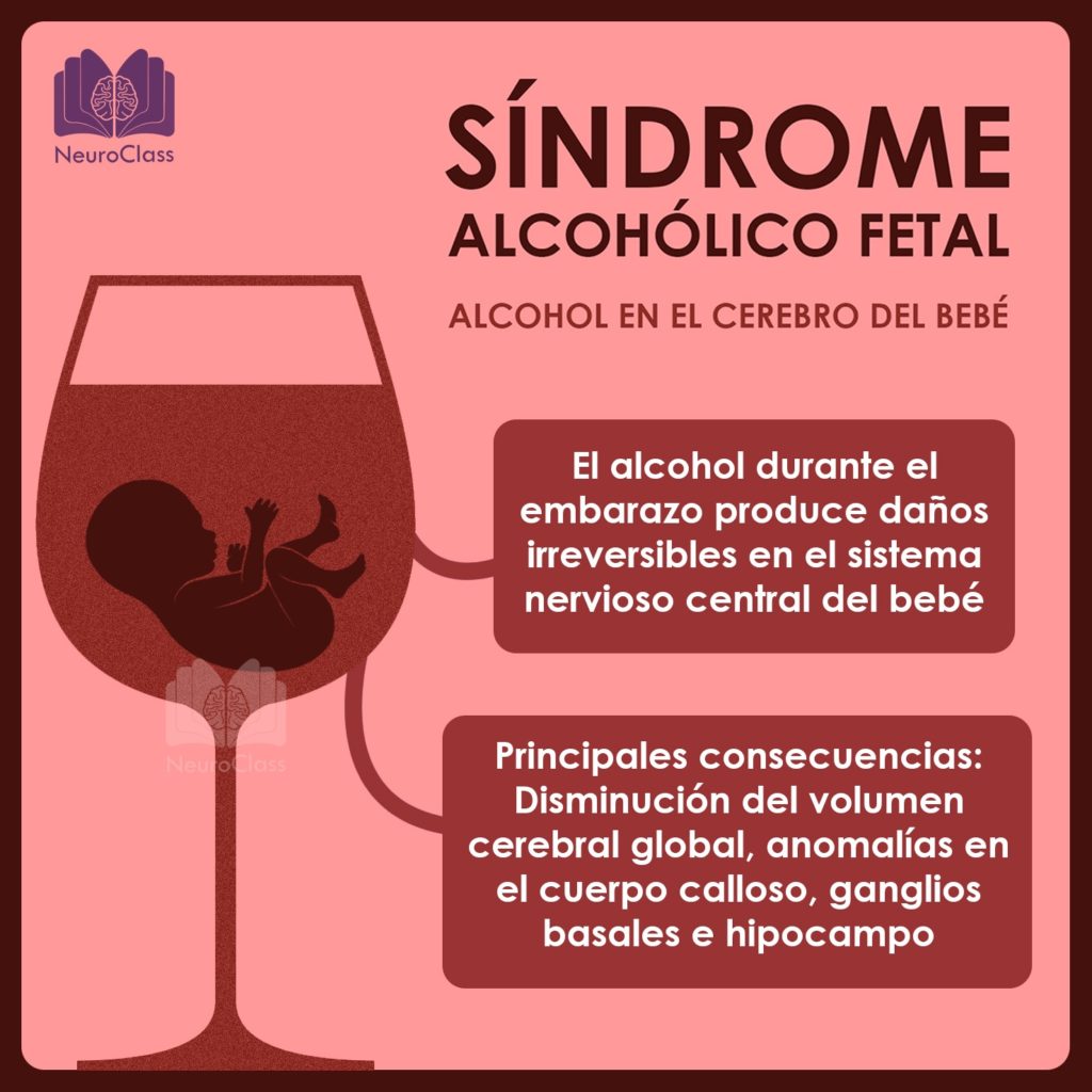 Síndrome Alcohólico Fetal: Alcohol En El Cerebro Del Bebé - NeuroClass