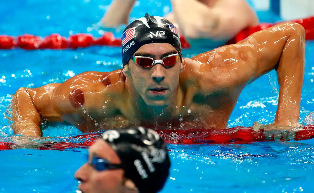 Michael Phelps: Prejuicios de los hombres y la psicoterapia
