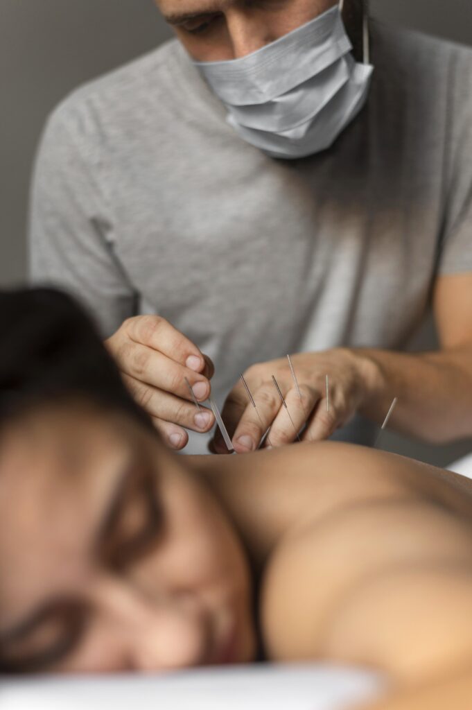acupuntura cerebro terapia alternativa