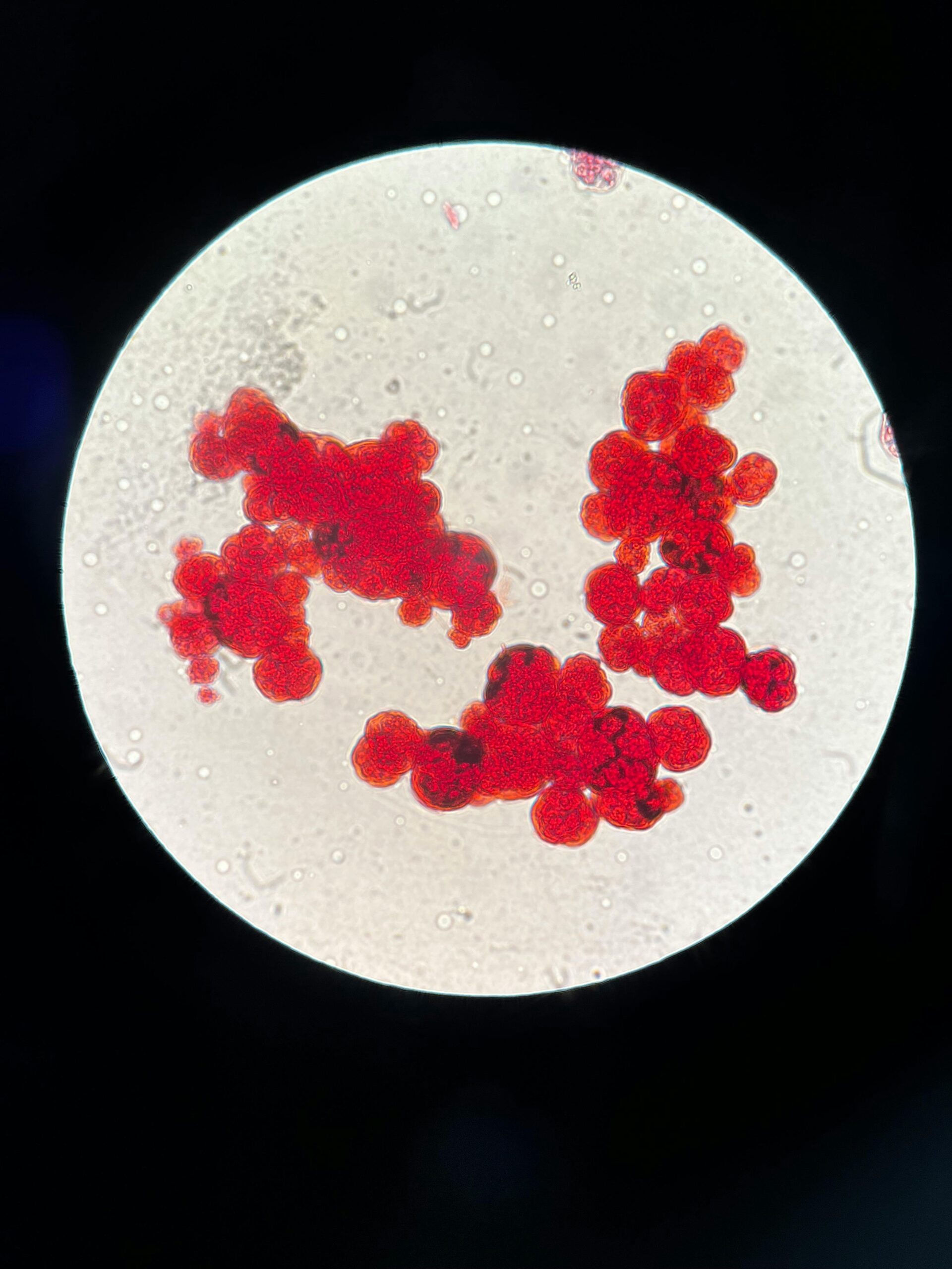 COVID-19 y demencia, pandemia, SARS-CoV-2, virus, deterioro cognitivo