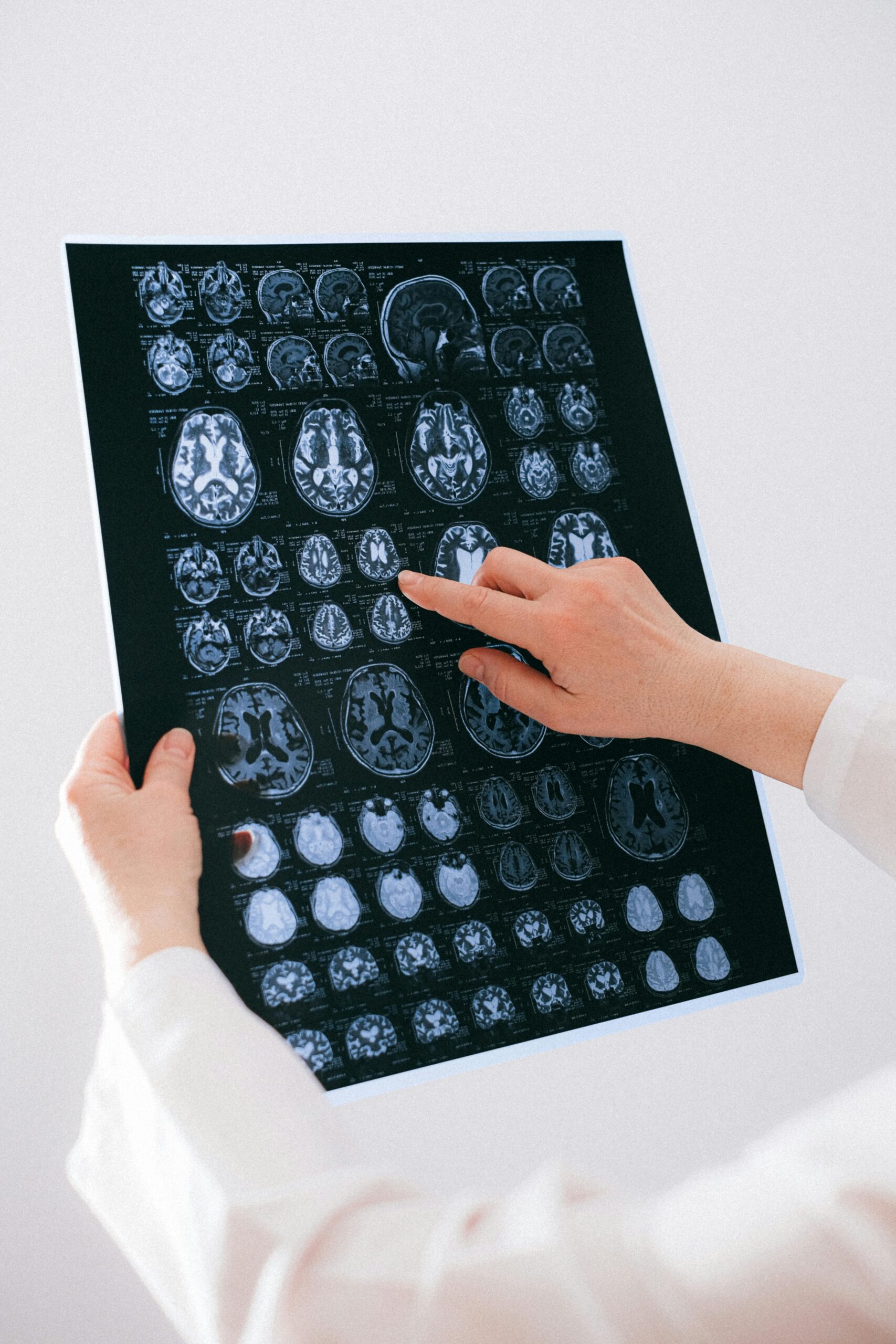 Psicodélicos y neuroplasticidad