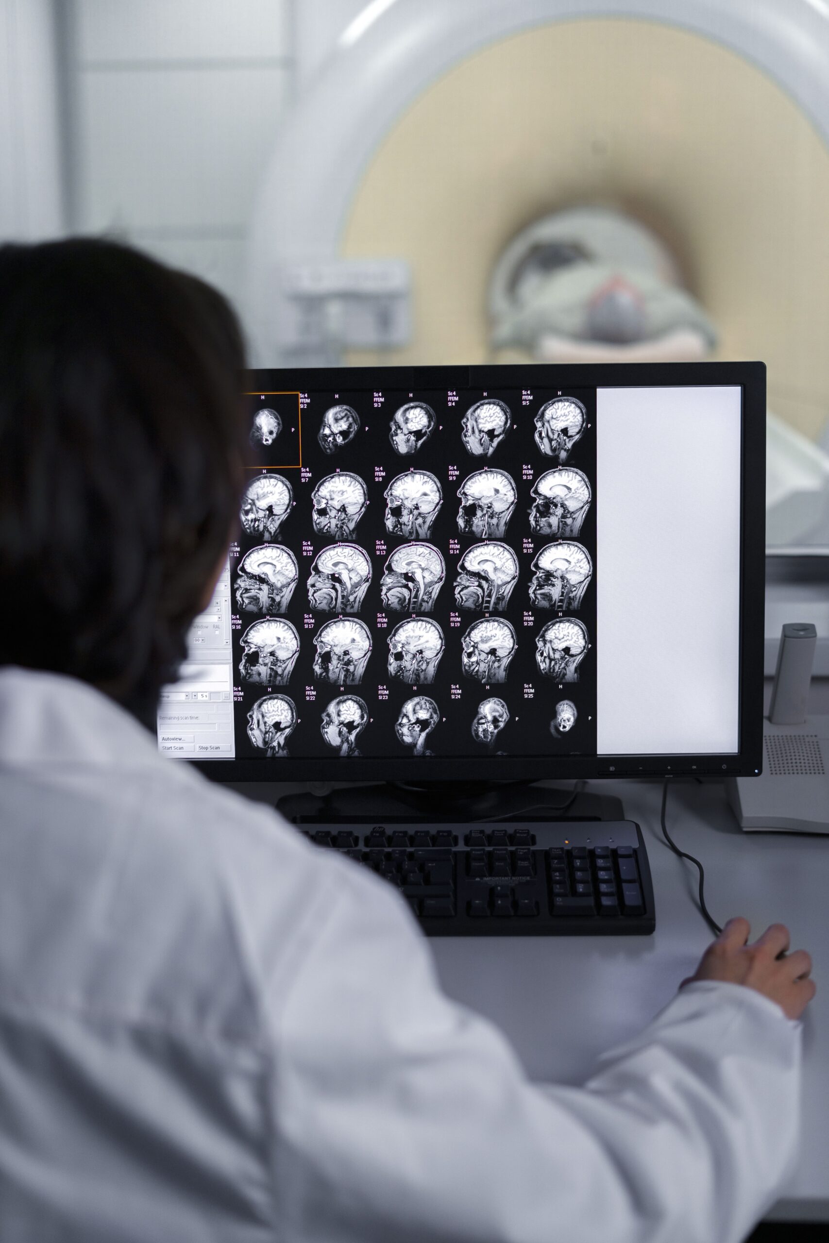 Cerebro y cambio, modelo de doble vía